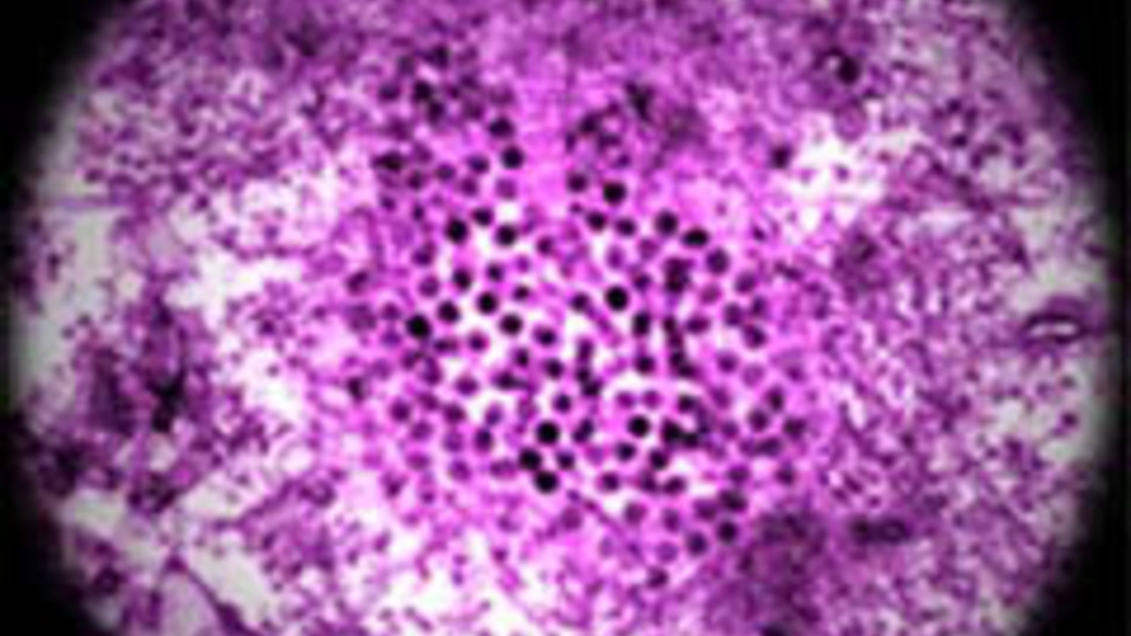 niaid-west-nile-wiki.jpg