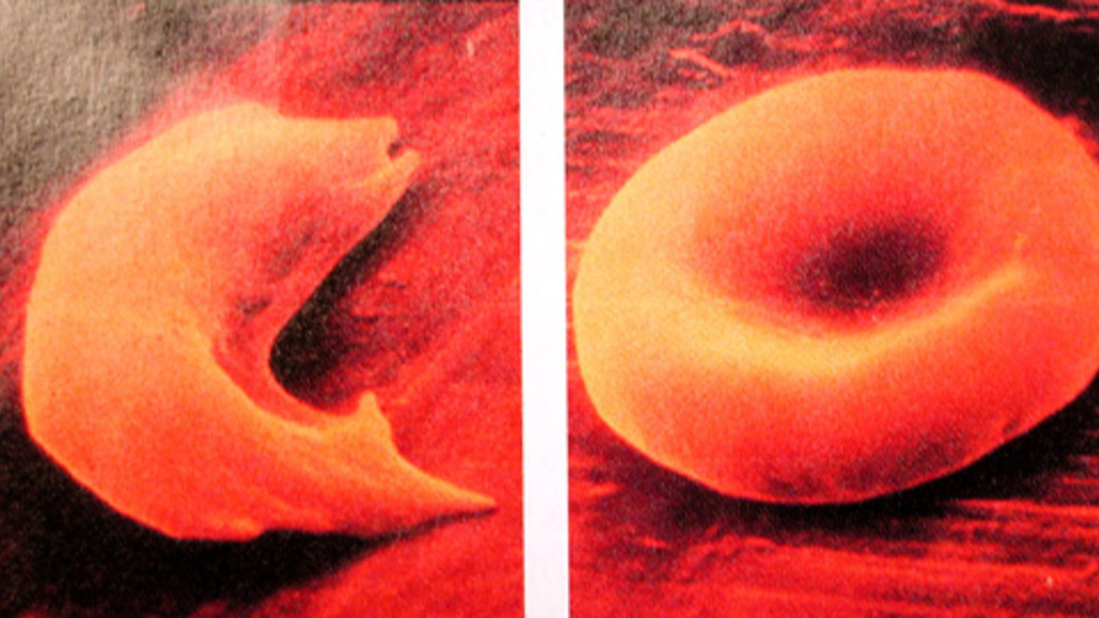 red_blood_cells.jpg