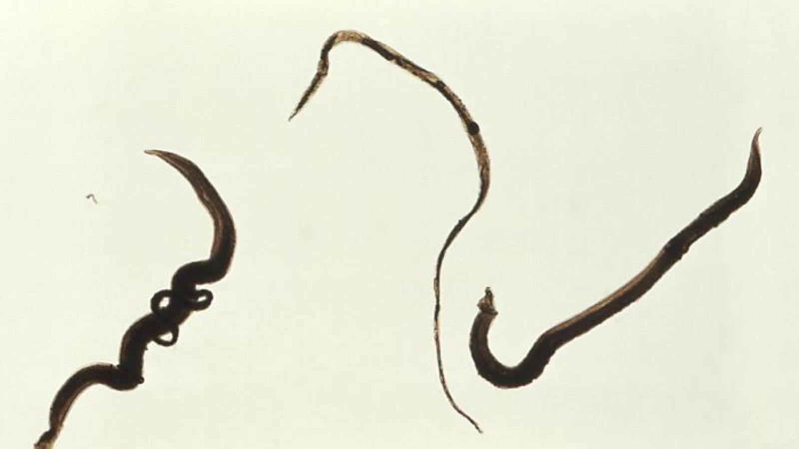 schistosoma_mansoni_trematodes.jpg