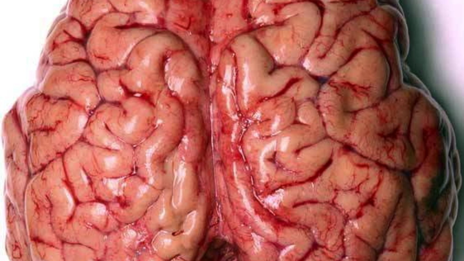 the-human-brain-neuroscience-4966969-562-800.jpg