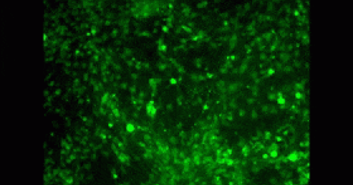 Les avancées spectaculaire de la microscopie à deux photons et de l ...