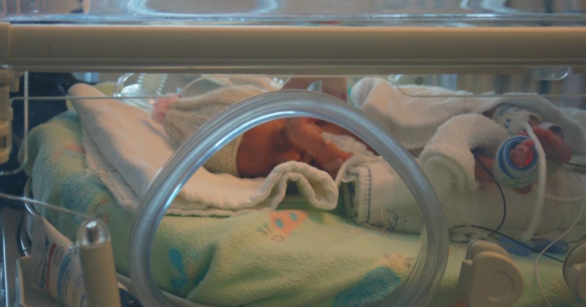 Many premature babies fall into adolescence