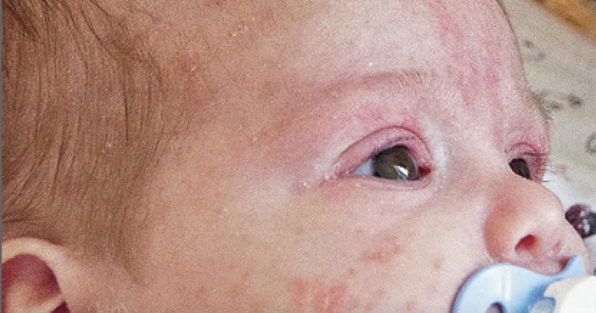 Des grands-parents se mobilisent pour défendre les vaccins