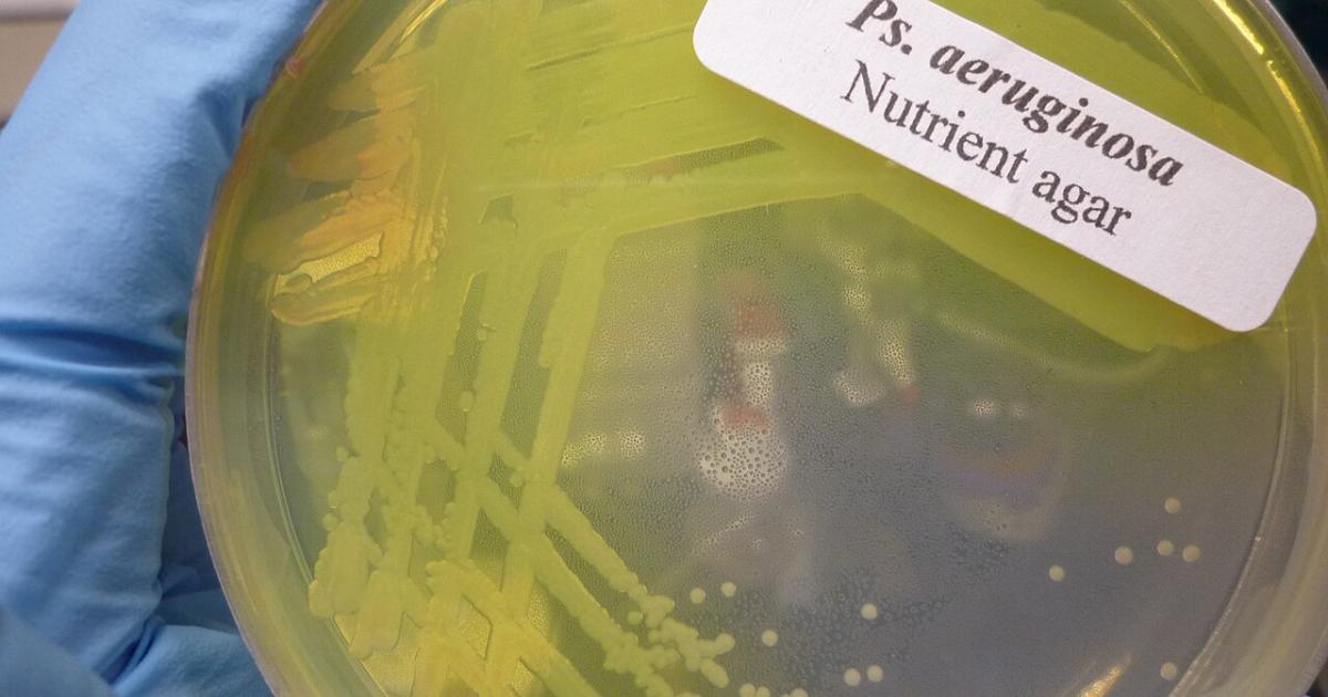 The story of dangerous bacteria The story of dangerous bacteria