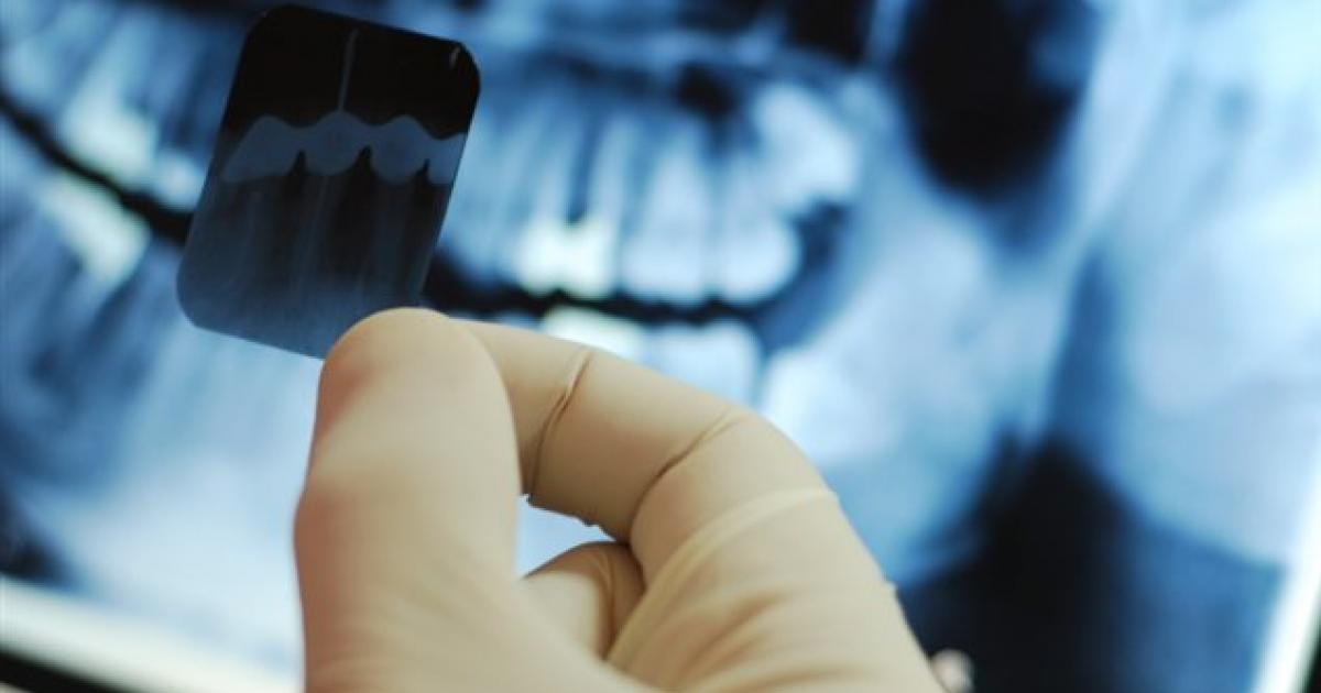Un dentista può migliorare la tua salute generale?