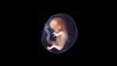 human-embryo.jpg (76.7 Ko)