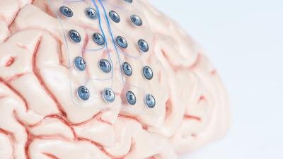 implant-cerveau-Dreamstime.jpg