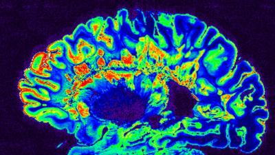 cerveau-scan.jpg