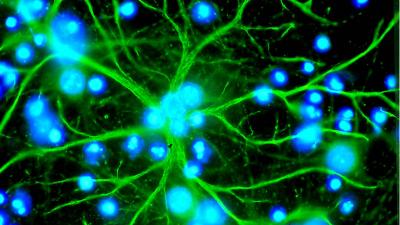 Astrocyte en culture émettant de nombreux prolongements étoilés