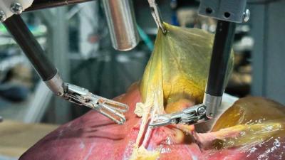 Robot chirurgien fait une opération
