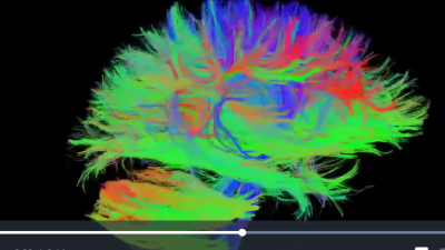 Connectome du cerveau humain