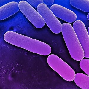 Klebsiella_pneumoniae