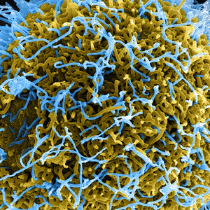 ebola-cellule