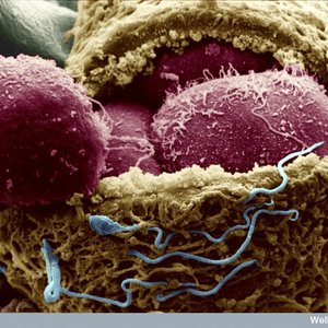 capsule Pascal Des bébés sur mesure Pas encore.jpg (320.08 Ko) 