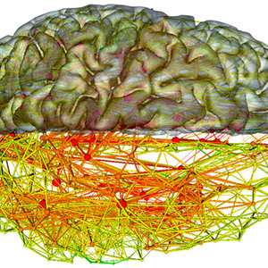 connectome