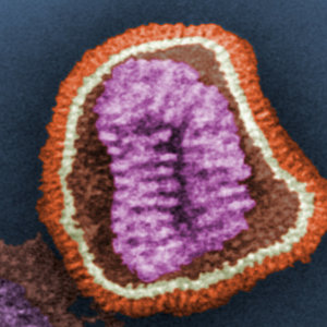 influenza