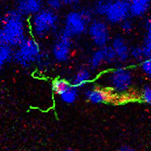 neurogenèse-Boldrini