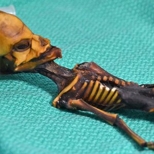 squelette-Atacama-fille