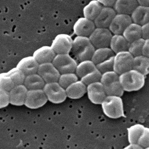 Acinetobacter.JPG (246.75 Ko) 