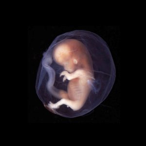 human-embryo.jpg (76.7 Ko)