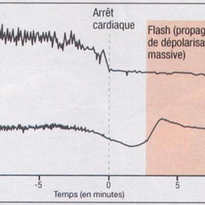 vague dépolarisation