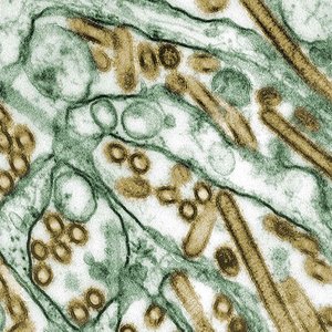 virus-grippe-H5N1
