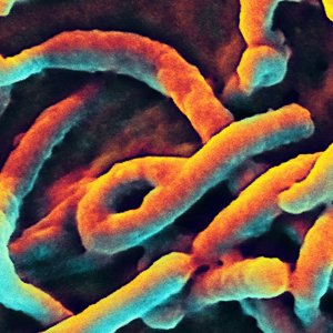 Ebola-microscopeelectronique