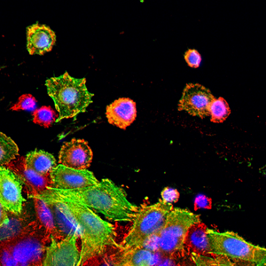 Colon cancer cells