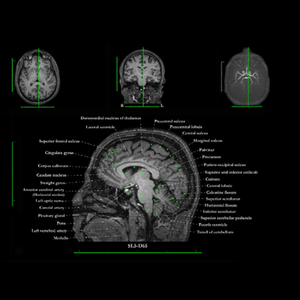 cerveau3.png (340.55 Ko) 