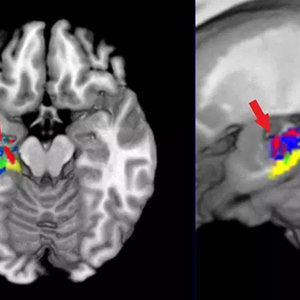 La trace de nos apprentissages observée dans l'hippocampe et le cortex