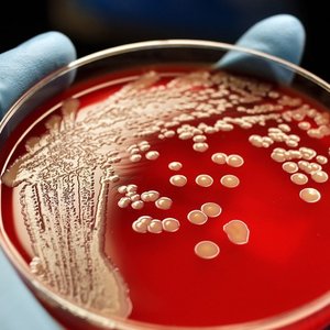 bacteries-petri-dish