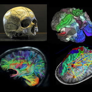 cerveau