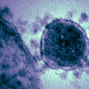 coronavirus
