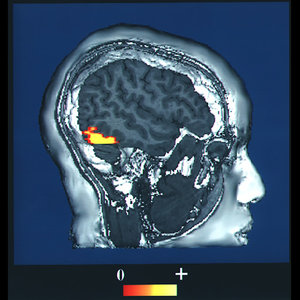 cerveau