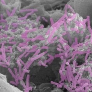 Bacterie-Lactobacillus_crispatus