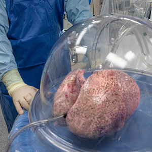 poumon-perfusion.jpg