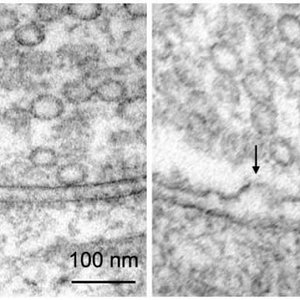 synapse-neurotransmission-neurosicnews.jpg