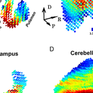 structures sous-corticale.png