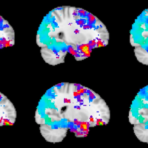 anticipation cortex visuel.png