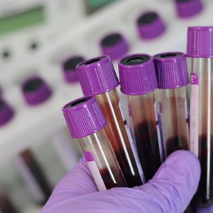 biobanque-echantillons.jpg