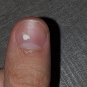 ongle-tache-blanche.jpg