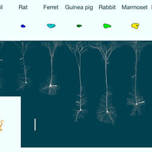 image_10262-Mammalian-Neurons.jpg