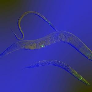 Vers nématodes 