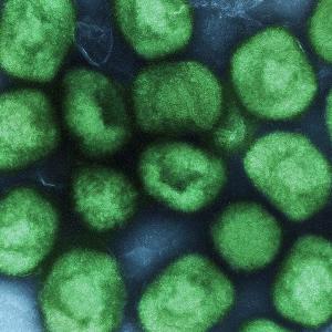 monkeypox-vert.jpg