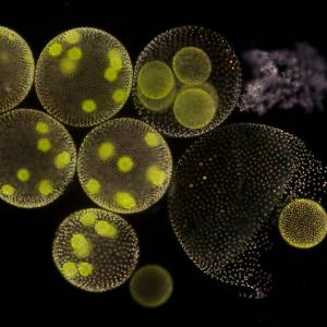 Microphotographie d'algues volvox