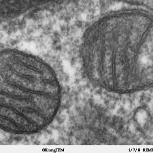 Mitochondries en microscopie électronique 