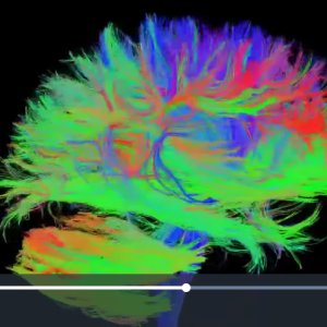 Connectome du cerveau humain