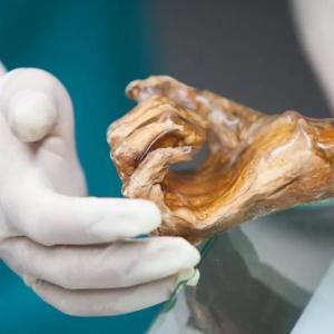 otzi-microbiome.jpg