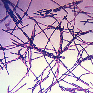 1280px-bacillus_anthracis_gram.jpg