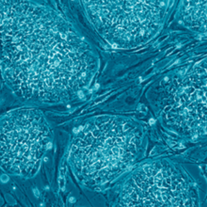 319px-human_embryonic_stem_cells.png